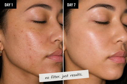 VONTORY Targeted Dark Spot Care, 1% Kojic Acid